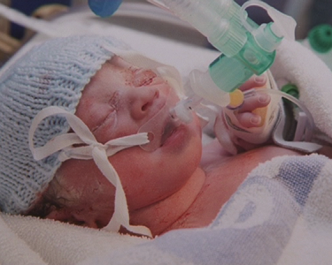 Unborn Baby Saved by Pioneering Operation in Leicester