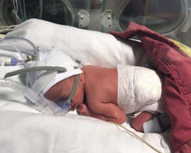 Leicester Hospitals Charity Launches Poignant Christmas Appeal to Help Premature Babies